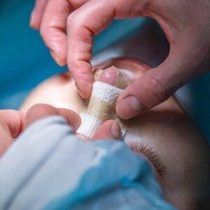 Rhinoplasty cost in Jeddah