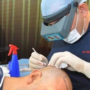 Hair Transplant Cost in Jeddah