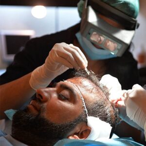 Is Hair Transplant is Safe?
