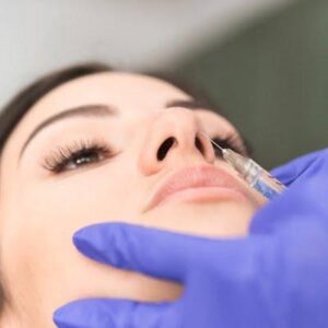 Non-Surgical Rhinoplasty using Dermal Fillers