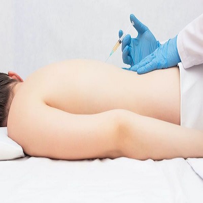 PRP injection for back pain